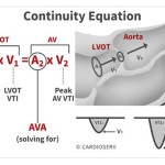 Continuity Equation Aortic Valve Area Calculation