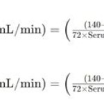 Creatinine Clearance Equation Calculator